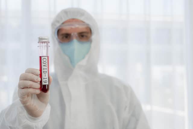 coronavirus gv or Covid 19 gv from Shutterstock