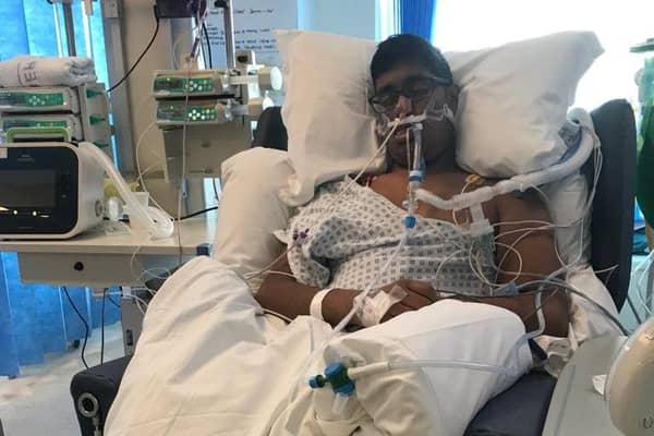 University of Portsmouth student Ben de Souza in Queen Alexandra Hospital after he fell ill with meningococcal septicaemia (MenB) which he mistook for a hangover