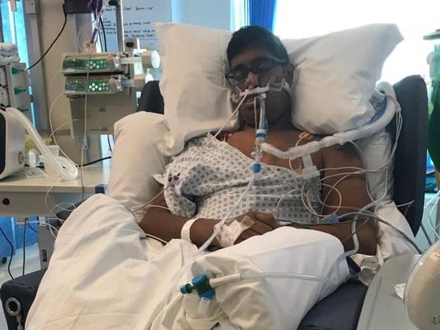 University of Portsmouth student Ben de Souza in Queen Alexandra Hospital after he fell ill with meningococcal septicaemia (MenB) which he mistook for a hangover