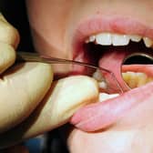 A lack of NHS dentists in Portsmouth is causing a crisis, city councillors have said  Photo: Rui Vieira/PA Wire