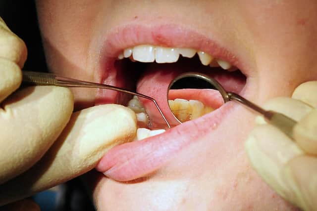 A lack of NHS dentists in Portsmouth is causing a crisis, city councillors have said Photo: Rui Vieira/PA Wire