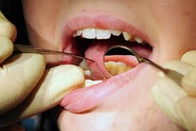 A lack of NHS dentists in Portsmouth is causing a crisis, city councillors have said  Photo: Rui Vieira/PA Wire