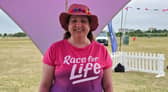 Becky James beat melanoma after getting a suspicious spot on her ear checked early.
