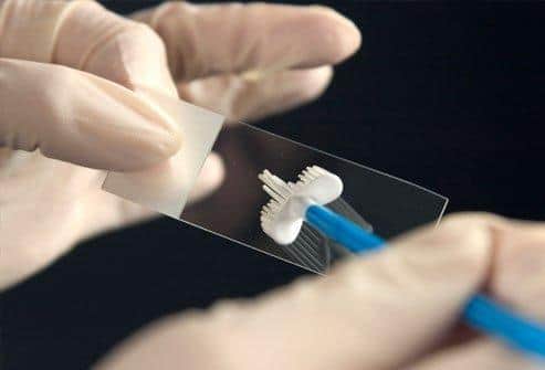 Concerns have been raised over smear test attendance.