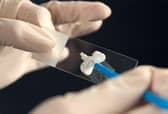 Concerns have been raised over smear test attendance.