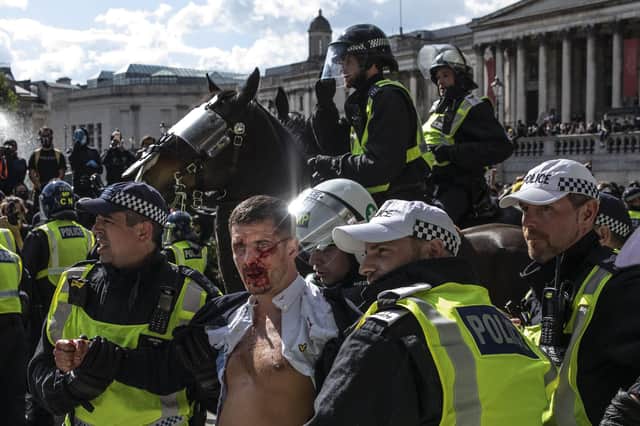 Police lead an injured man away after clashes between protesters in Trafalgar Square on June 13. Following a social media post by the far-right activist known as Tommy Robinson, members of far-right linked groups have gathered around statues in the capital. Photo by Dan Kitwood/Getty Images