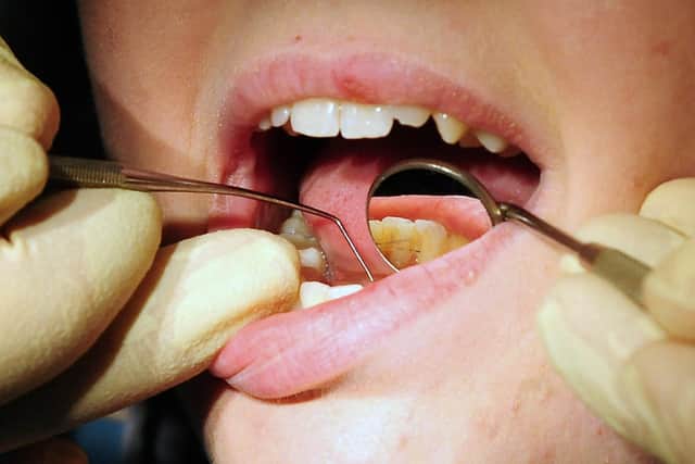 Bupa Dental Care is set to cut 85 dental practices in a move that will affect 1,200 staff across the UK, amid a national shortage of dentists and 'systemic' challenges across the industry. Picture: Rui Vieira/PA.