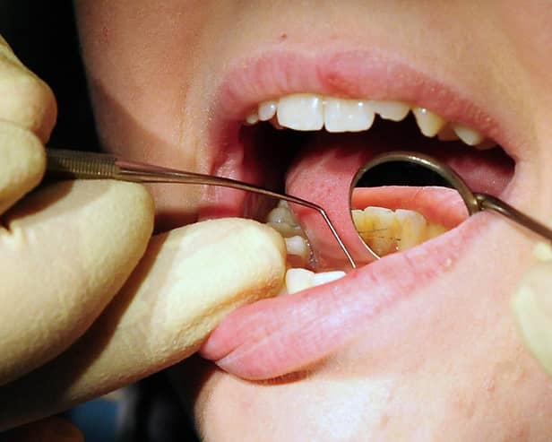 Bupa Dental Care is set to cut 85 dental practices in a move that will affect 1,200 staff across the UK, amid a national shortage of dentists and 'systemic' challenges across the industry. Picture: Rui Vieira/PA.