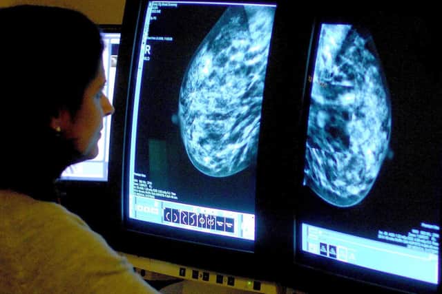 A consultant analysing a mammogram.