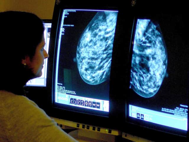 A consultant analysing a mammogram.