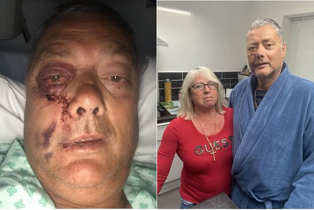 Left, Ross Tyrrell, 63, pictured in hospital following the attack outside his home on Saturday and, right, Ross and his wife, Jane, 63, at home on Thursday evening
