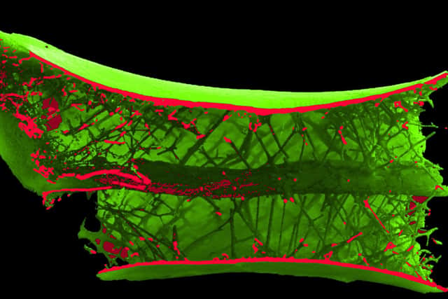 CT scan of the pterosaur bone, showing the spoke-like structures arranged in a helix around a central tube inside the vertebra.