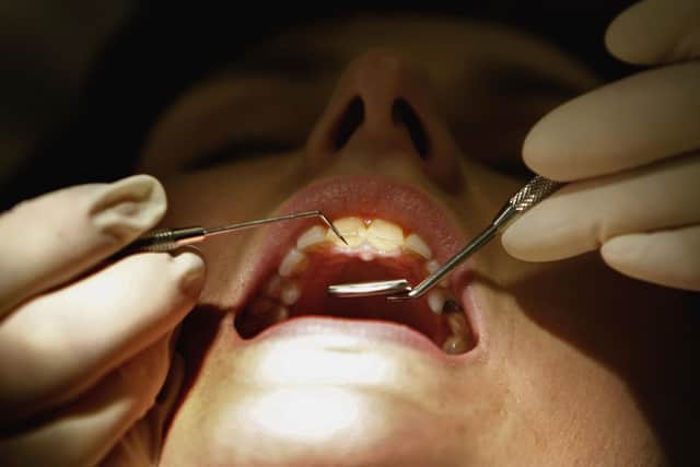 Two new NHS dental providers in Portsmouth are set to be ready for new patients in April.
Photo: Getty Images