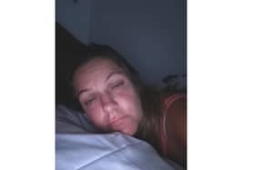 Laura Harris, 40 from Lee-on-the-Solent, has started treatment affter living with Lyme disease for years. Pictured: Laura on a bad day of symptoms