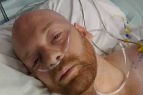 Moments after waking up from surgery. I don't remember it being taken.