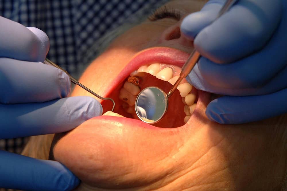 Dentist. John Giles/PA Wire