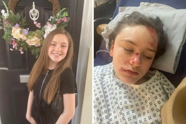 10-year-old Millie-Rae Herbert was struck by a car on Eastern Road at about 11am on Sunday, March 5.

Picture: Michelle Price