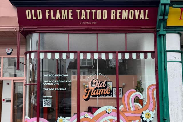 Southseas new tattoo removal studio standing out on the high street