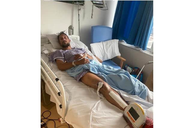 Scott Lemon, 42, was hospitalised after being hit by a van on the A32 near Wickham. He had to have operations at Southampton General Hospital.