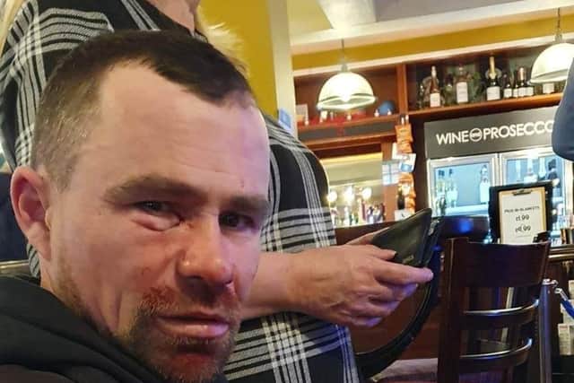 Catalin who was attacked with a knuckle duster at John Jacques pub in Fratton on April 18.