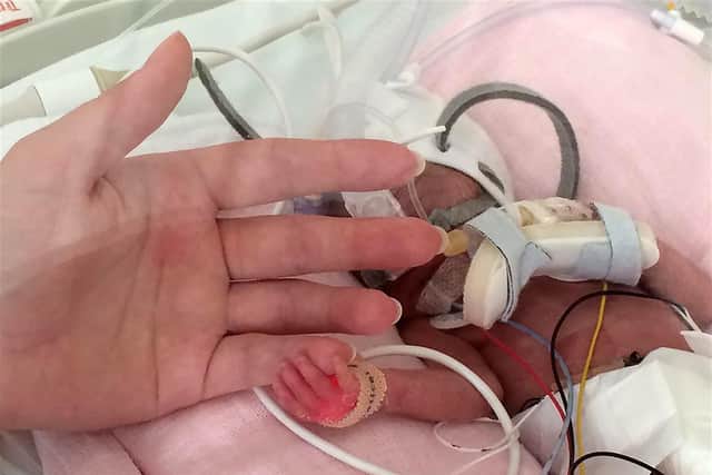 Jasmine one of a set of twins born prematurely, as their father Ross Pollock is aiming to roller skate 1,000 miles to raise money for a neonatal charity in which his twins spent months in hospital after being born prematurely. Issue date: Thursday May 12, 2022.