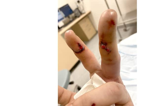 Terri Finney's injuries