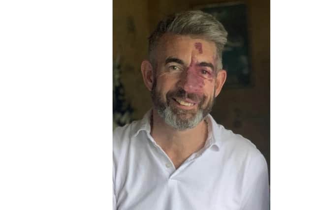Richard Morris disappeared while on a run 15 weeks ago.