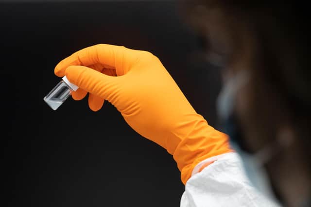 A laboratory test. Picture: PATRICK HERTZOG/AFP via Getty Images