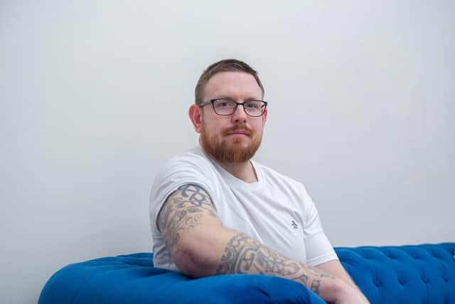 Dan Fallon broke his arm but had to wait 16 days for an operation as it wasn't deemed critical by the NHS. It's healed wonky as a result and he had a botched pin operation which means he may never regain the use of his right armPictured: Dan Fallon at his home in North End, Portsmouth on Tuesday 8th February 2022Picture: Habibur Rahman
