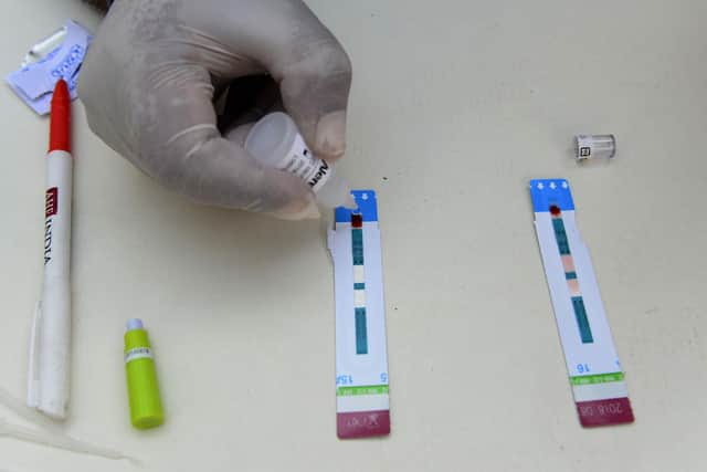 STI test. Picture: SAJJAD HUSSAIN/AFP via Getty Images