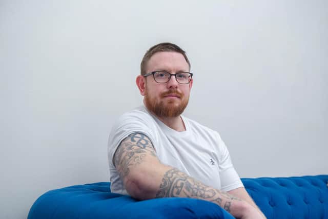 Dan Fallon broke his arm but had to wait 16 days for an operation as it wasn't deemed critical by the NHS. It's healed wonky as a result and he had a botched pin operation which means he may never regain the use of his right arm
Pictured: Dan Fallon at his home in North End, Portsmouth on Tuesday 8th February 2022
Picture: Habibur Rahman