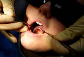 Dentist practices will be allowed to open next month. Picture: Rui Vieira/PA Wire