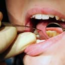 Dentists in Portsmouth had almost two dozen admissions for tooth extractions on children with tooth decay in the year to March