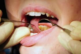 Dentists in Portsmouth had almost two dozen admissions for tooth extractions on children with tooth decay in the year to March