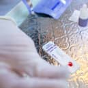 Lateral flow test. Picture: Shutterstock