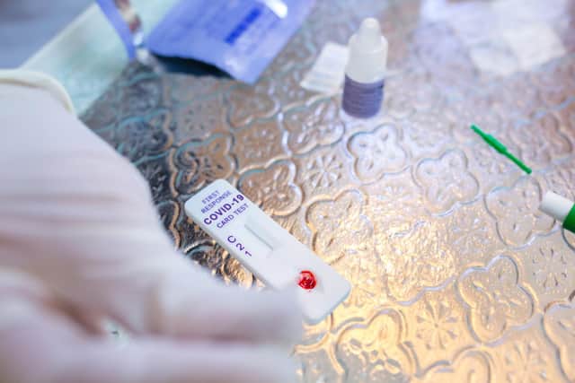 Lateral flow test. Picture: Shutterstock