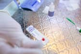 Lateral flow test. Picture: Shutterstock