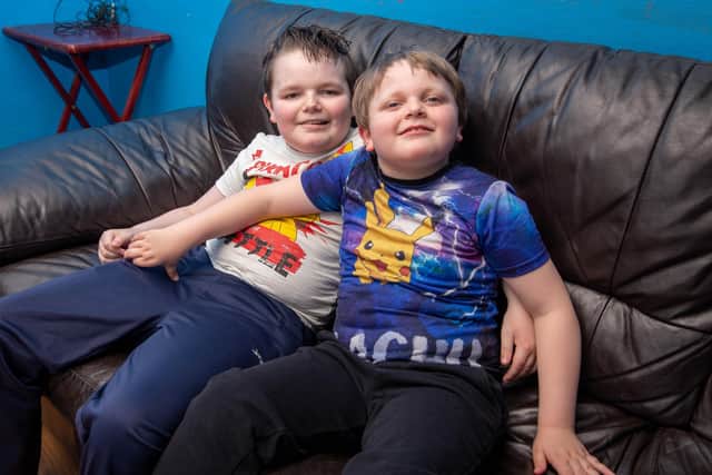 Alex Hoare has a very rare incurable genetic disease called Neurofibromatosis type 2

Pictured:  Shauny Hoare 8 and Alex Hoare 10 at their home 

Picture: Habibur Rahman