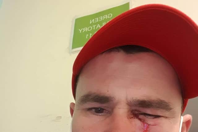 Catalin who was attacked with a knuckle duster at John Jacques pub in Fratton on April 18.
