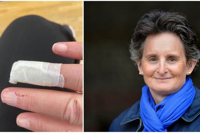 Meon Valley MP Flick Drummond was bitten by a dog while campaigning