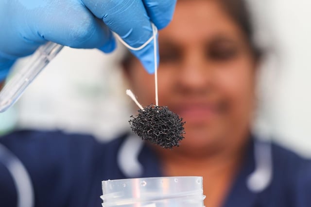 As th sponge is pulled out, it takes samples from the patients oesophagus which can be screened for Barrett's oesophagus or oesophageal cancer.