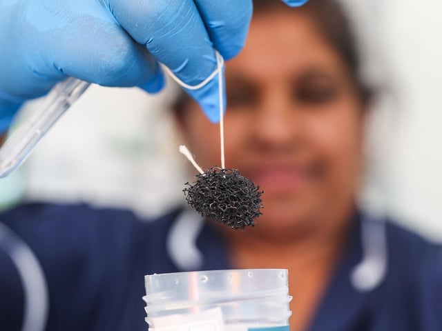 As th sponge is pulled out, it takes samples from the patients oesophagus which can be screened for Barrett's oesophagus or oesophageal cancer.
