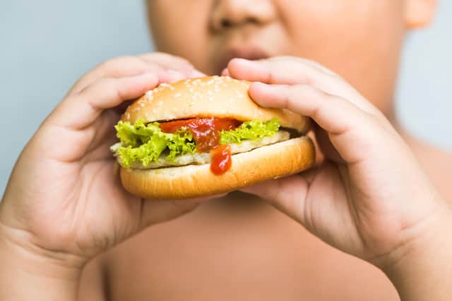 childhood obesity