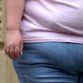More than 3,000 people in Portsmouth were admitted to hospital either with a primary or secondary diagnosis of obesity. Picture: PA Wire