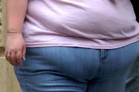 More than 3,000 people in Portsmouth were admitted to hospital either with a primary or secondary diagnosis of obesity. Picture: PA Wire