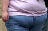 More than 3,000 people in Portsmouth were admitted to hospital either with a primary or secondary diagnosis of obesity. Picture: PA Wire
