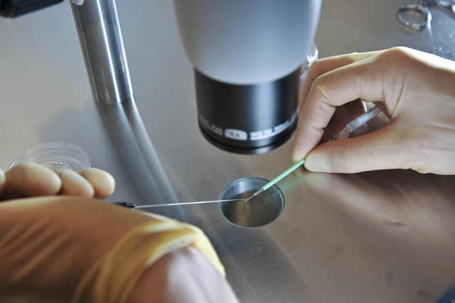 Embryos being placed onto a CryoLeaf ready for instant freezing using a vitrification process for IVF.. Photo credit should read: Ben Birchall/PA Wire