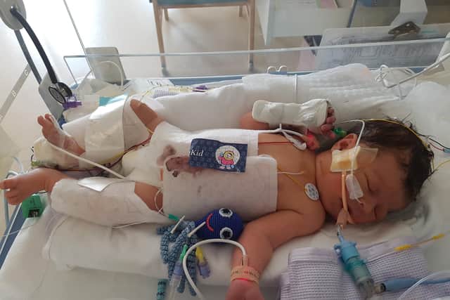 Charlie Wagstaff has one f the World's rarest conditions where hehas to be on a ventilator mask when he sleeps or he could die. 
Pictured: Charlie when he was in hospital