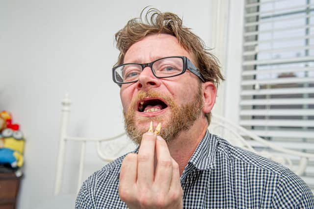 Chris Savage in his home with the teeth that he pulled out. Picture: Habibur Rahman