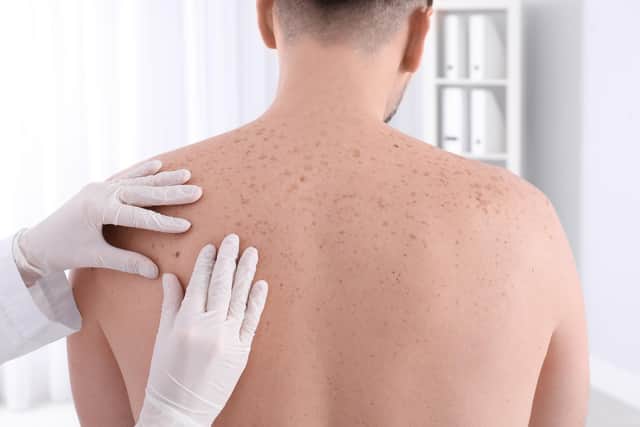 Doctor examining patient in clinic. Visiting dermatologist